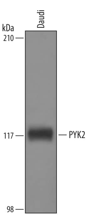 Detection of Human PYK2/FAK2 antibody by Western Blot.