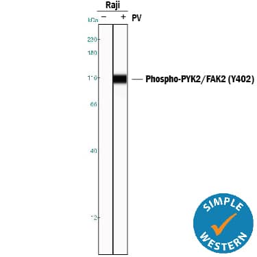 Detection of Human Phospho-PYK2/FAK2 (Y402) antibody by Simple WesternTM.