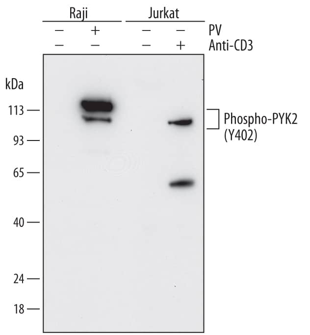 Detection of HumanPhospho-PYK2/FAK2 (Y402) antibody by Western Blot.