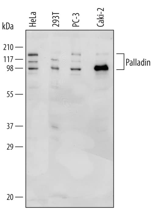 Detection of Human Palladin antibody by Western Blot.