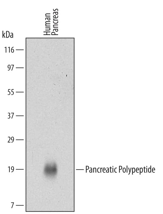 Detection of Human Pancreatic Polypeptide antibody by Western Blot.