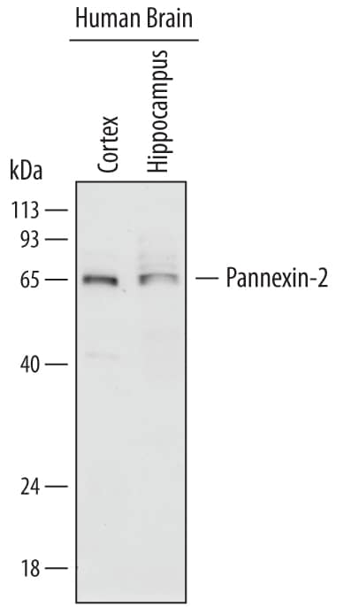 Detection of Human Pannexin-2 antibody by Western Blot.