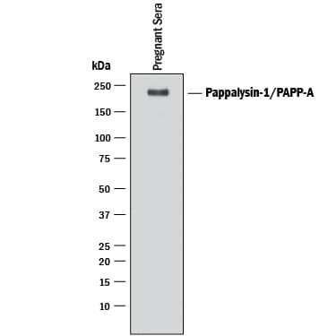 Detection of Human Pappalysin-1/ PAPP-A antibody by Western Blot.