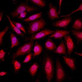 Park7/DJ-1 antibody in HeLa Human Cell Line by Immunocytochemistry (ICC).