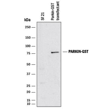 Detection of Human Parkin antibody by Western Blot.