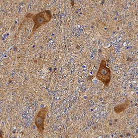 Parkin antibody in Human Brain by Immunohistochemistry (IHC-P).