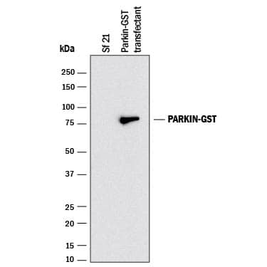 Detection of Human Parkin antibody by Western Blot.