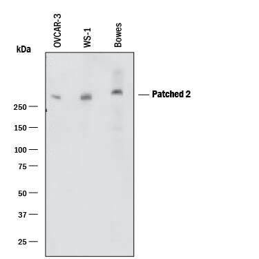 Detection of Human Patched 2/PTCH2 antibody by Western Blot.