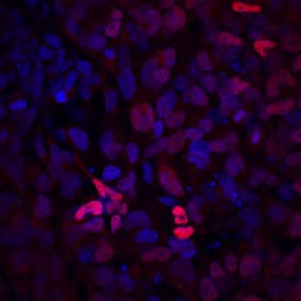 Pax2 antibody in BG01V Human Embyonic Stem Cells by Immunocytochemistry (ICC).