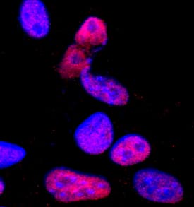 Pax3 antibody in B16-F1 Mouse Cell Line by Immunocytochemistry (ICC).