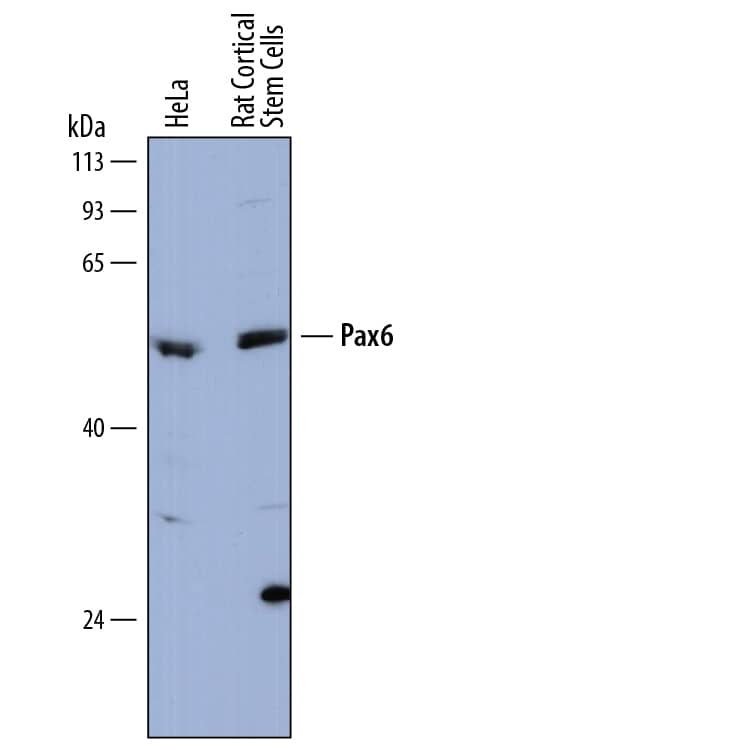 Detection of Human and Rat Pax6 antibody by Western Blot.