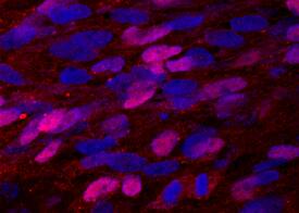 Pax7 antibody in iBJ6 iPS Cell Line by Immunocytochemistry (ICC).