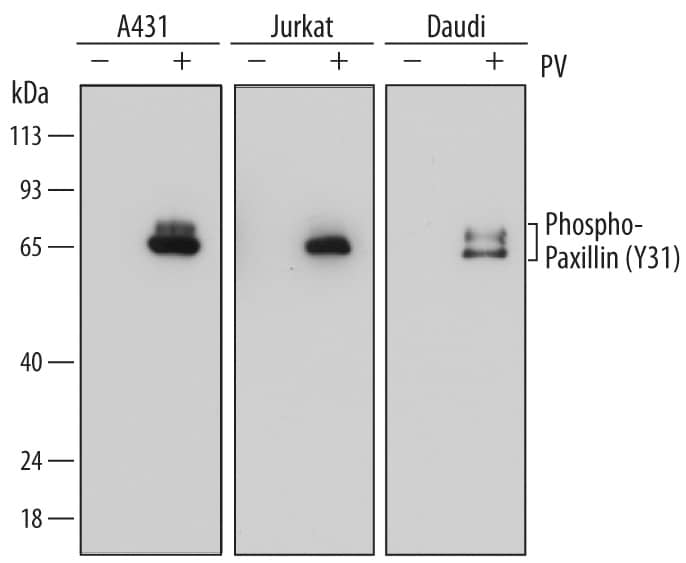 Detection of Human Phospho-Paxillin (Y31) antibody by Western Blot.