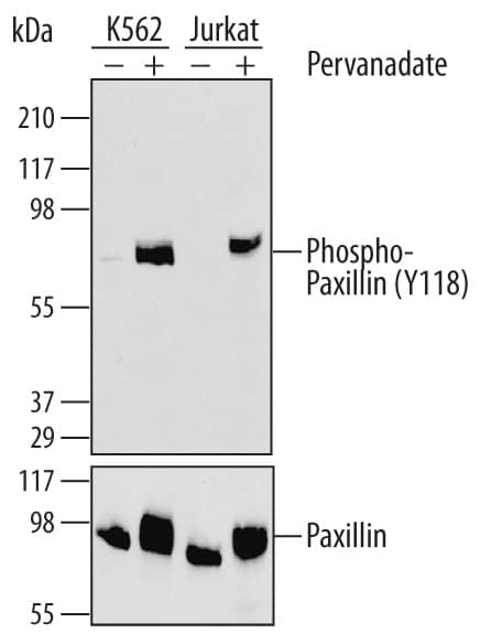 Detection of Human Phospho-Paxillin (Y118) antibody by Western Blot.