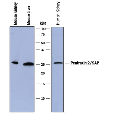 Detection of Human and Mouse Pentraxin 2/SAP antibody by Western Blot.