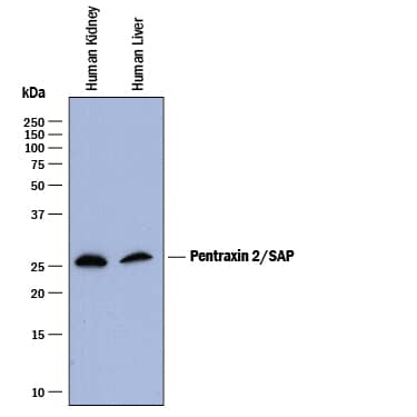 Detection of Human Pentraxin 2/SAP antibody by Western Blot.