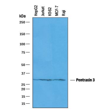 Detection of Human Pentraxin 3/TSG-14 antibody by Western Blot.