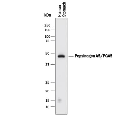 Detection of Human Pepsinogen A5/PGA5 antibody by Western Blot.