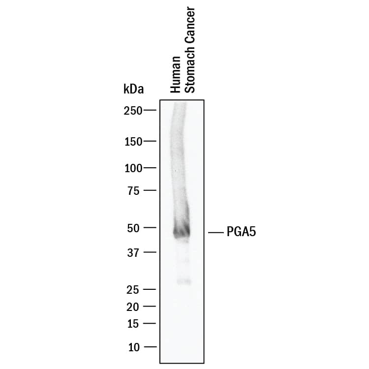 Detection of Human Pepsinogen A5/PGA5 antibody by Western Blot.