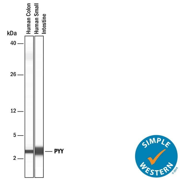 Detection of Human Peptide YY antibody by Simple WesternTM.