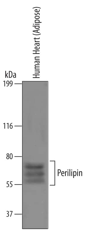 Detection of Human Perilipin antibody by Western Blot.