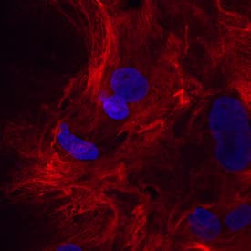 Periostin/OSF-2 antibody in Rat Mesenchymal Stem Cells by Immunocytochemistry (ICC).