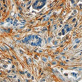 Periostin/OSF-2 antibody in Human Breast by Immunohistochemistry (IHC-P).