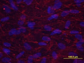 Periostin/OSF-2 antibody in Human Osteocytes by Immunocytochemistry (ICC).