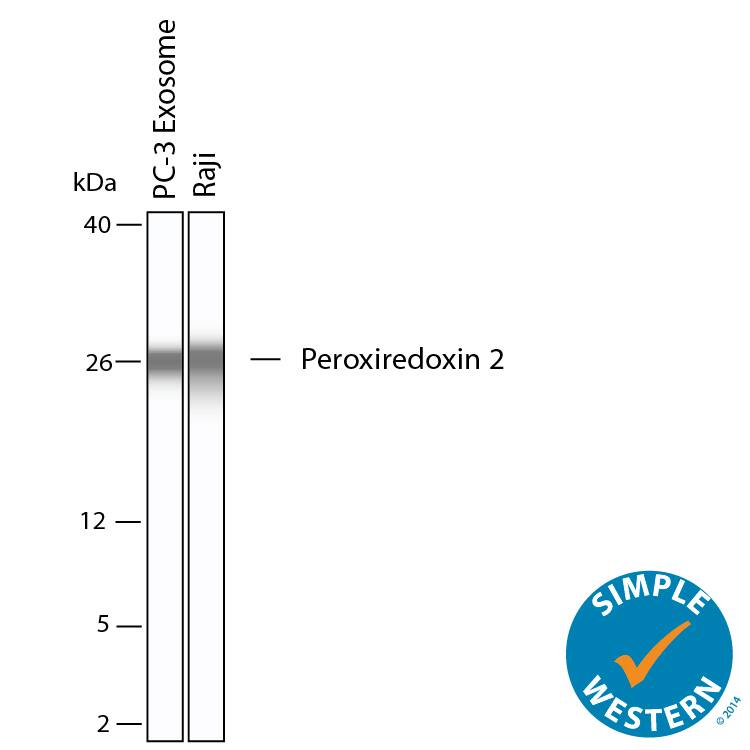 Detection of Human Peroxiredoxin 2 antibody by Simple WesternTM.