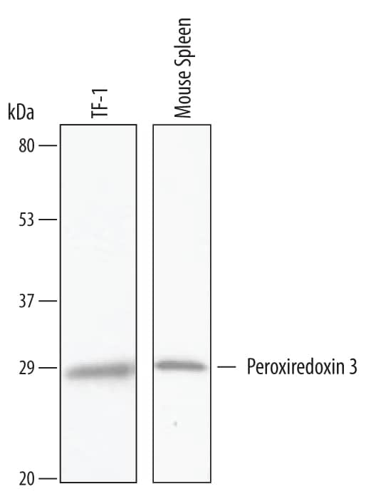 Detection of Human and Mouse Peroxiredoxin 3 antibody by Western Blot.