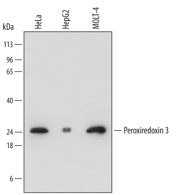 Detection of Human Peroxiredoxin 3 antibody by Western Blot.