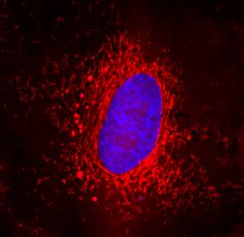 Peroxiredoxin 5 antibody in A549 Human Cell Line by Immunocytochemistry (ICC).