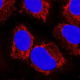 Peroxiredoxin 5 antibody in A549 Human Cell Line by Immunocytochemistry (ICC).