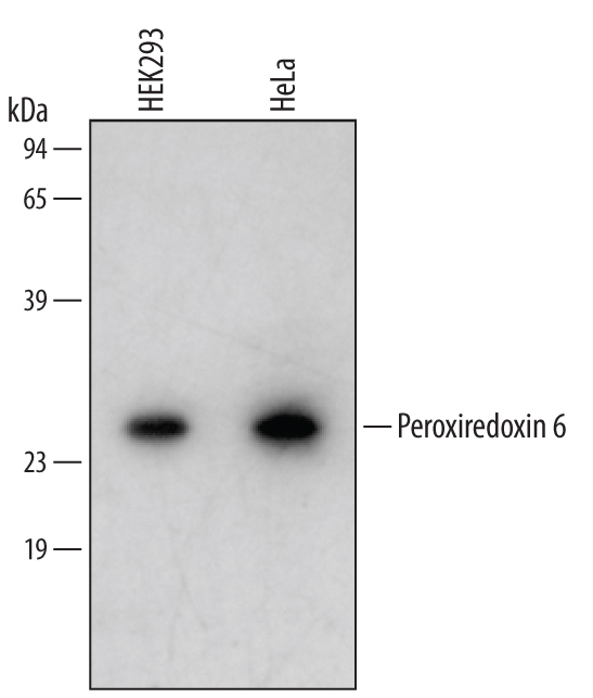 Detection of Human Peroxiredoxin 6 antibody by Western Blot.