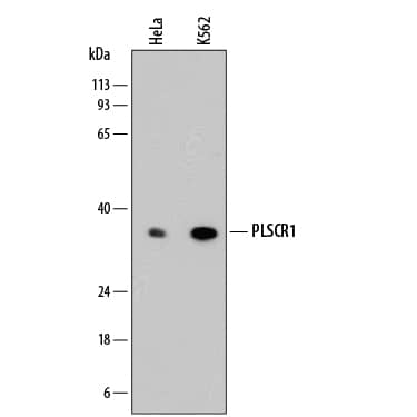 Detection of Human Phospholipid Scramblase 1/PLSCR1 antibody by Western Blot.