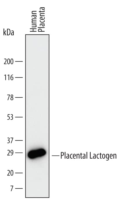 Detection of Human Placental Lactogen/CSH1 antibody by Western Blot.