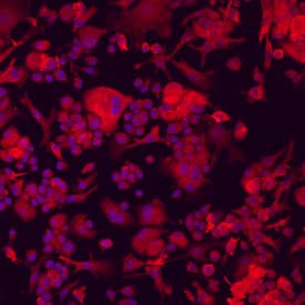 Plexin A1 antibody in Human Dendritic Cells by Immunocytochemistry (ICC).