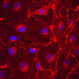 Plexin A2 antibody in bEnd by Immunocytochemistry (ICC).3 Mouse Cell Line by Immunocytochemistry (ICC).
