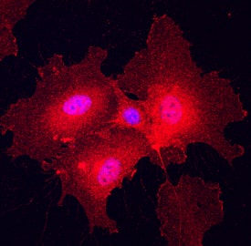 Plexin A2 antibody in HUVEC Human Cells by Immunocytochemistry (ICC).