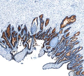 Plexin B1 antibody in Human Prostate by Immunohistochemistry (IHC-P).