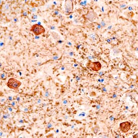 Plexin B1 antibody in Human Brain by Immunohistochemistry (IHC-P).