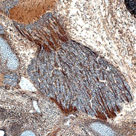 Plexin B2 antibody in Mouse Embryo by Immunohistochemistry (IHC-Fr).