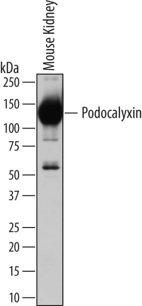 Detection of Mouse Podocalyxin antibody by Western Blot.