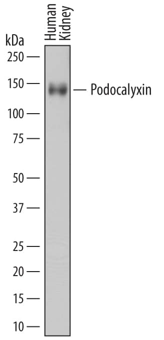 Detection of Human Podocalyxin antibody by Western Blot.