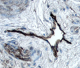 Podoplanin antibody in Human Uterus by Immunohistochemistry (IHC-P).
