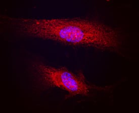 Polycystin-1/PKD1 antibody in Human HUVEC by Immunocytochemistry (ICC).