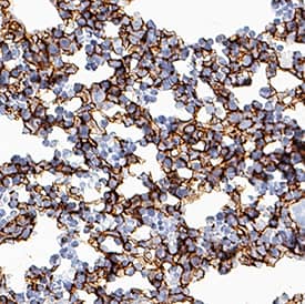 Pref-1/DLK1/FA1 antibody in Mouse Embryonic Liver Tissue by Immunohistochemistry (IHC-Fr).
