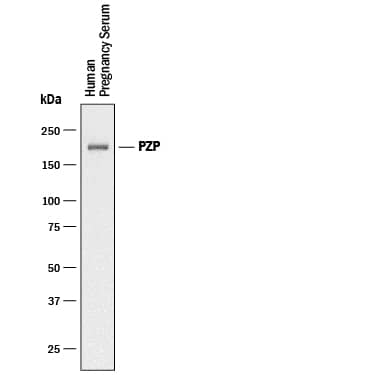 Detection of Human Pregnancy Zone Protein/PZP antibody by Western Blot.