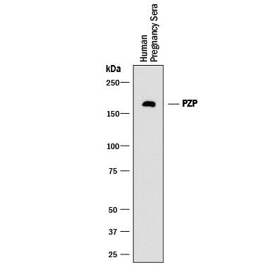 Detection of Human Pregnancy Zone Protein/PZP antibody by Western Blot.