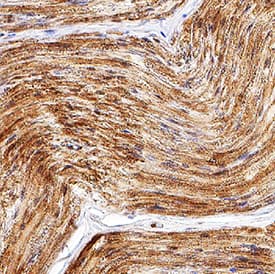 CGRP antibody in Human Dorsal Root Ganglion by Immunohistochemistry (IHC-P).